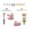 The LOCATOR Advantage: Choosing Between R-Tx Abutments and FIXED Solutions