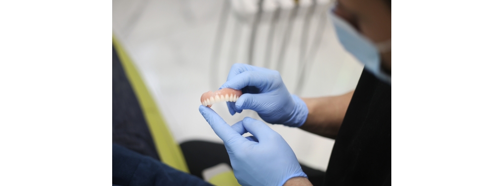 Dental professional wearing blue latex gloves holds an overdenture prosthetic. 