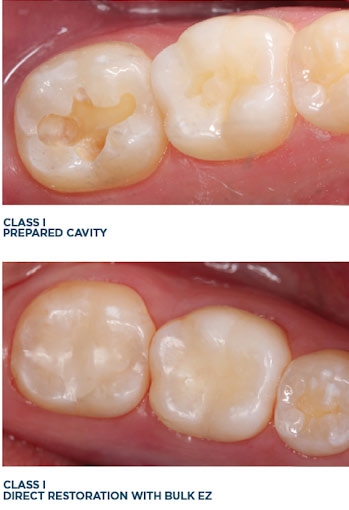 before and after