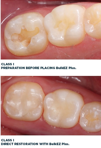 before and after