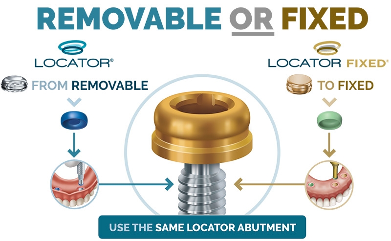 locator fixed infographic